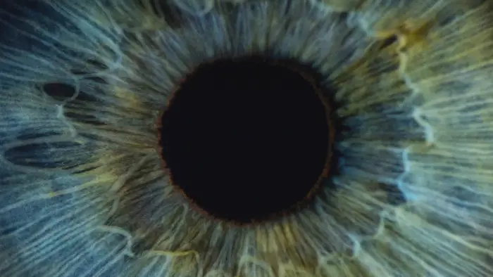 What is Coloboma? | Discover Causes & Symptoms | Fight For Sight