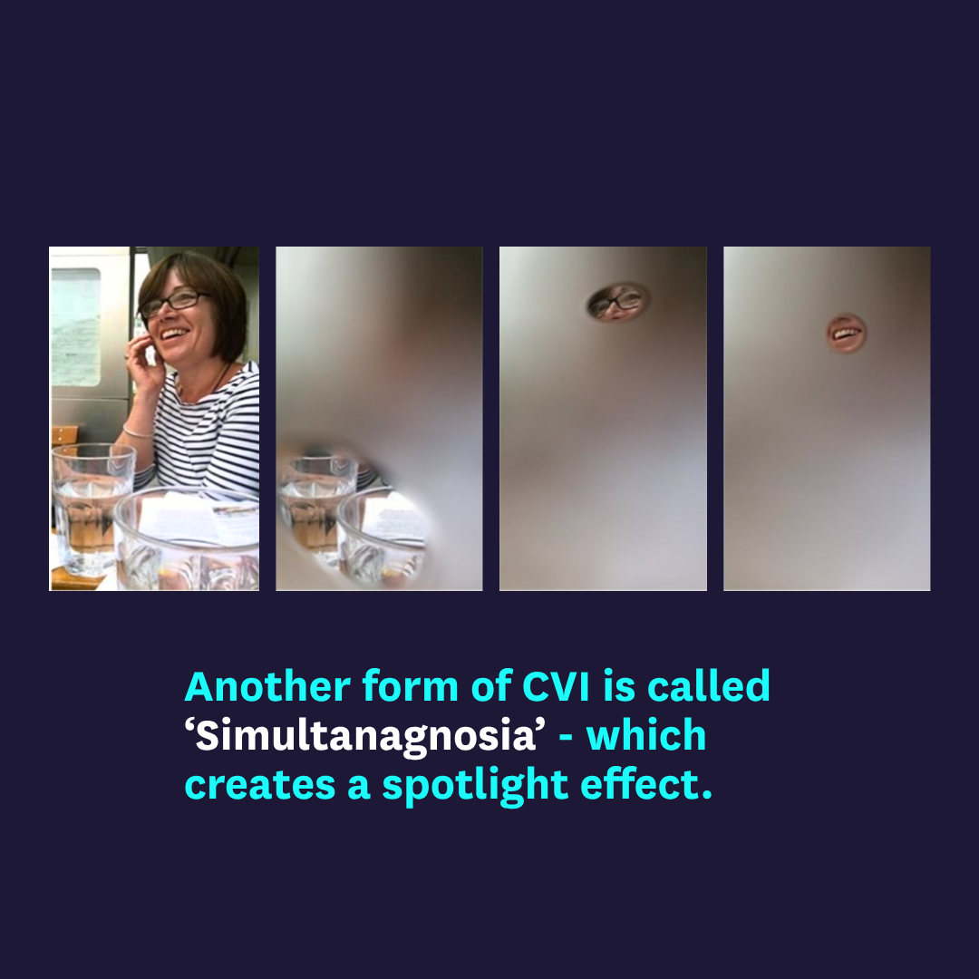 CVI Cerebral Visual Impairment - How a face can look if you have Simultanagnosia or Spotlight effect - Fight for Sight. Image courtesy of CVI Scotland.